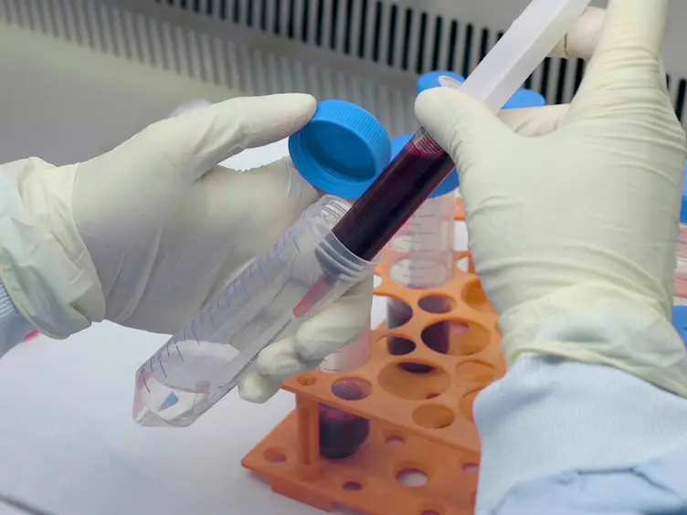 Megakaryocyte Differentiation and Platelet Formation from Human Cord Blood-derived CD34<sup>+</sup> Cells