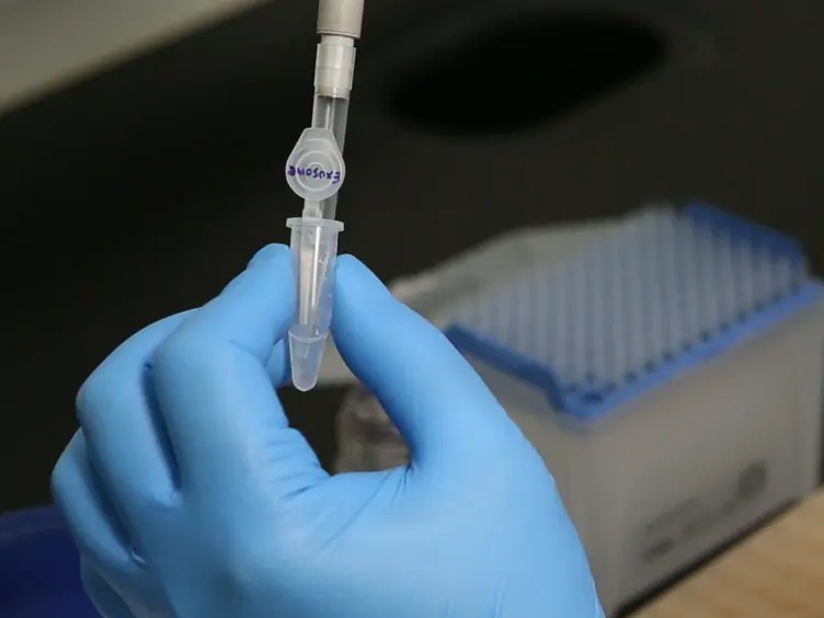 Sample Preparation and Imaging of Exosomes by Transmission Electron Microscopy