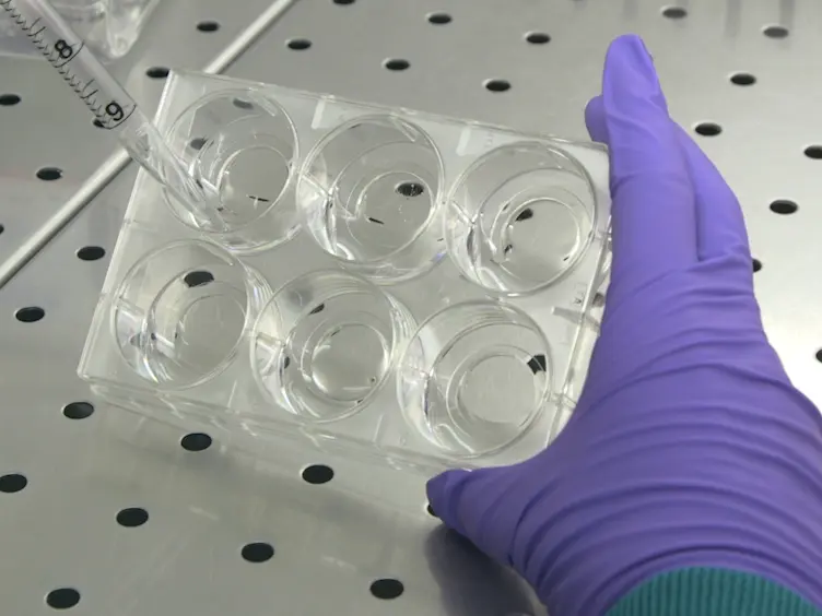 Lens-free Video Microscopy for the Dynamic and Quantitative Analysis of Adherent Cell Culture
