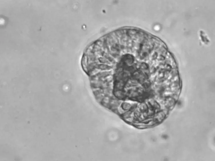 Immuno-fluorescent Labeling of Microtubules and Centrosomal Proteins in <em>Ex Vivo</em> Intestinal Tissue and 3D <em>In Vitro</em> Intestinal Organoids
