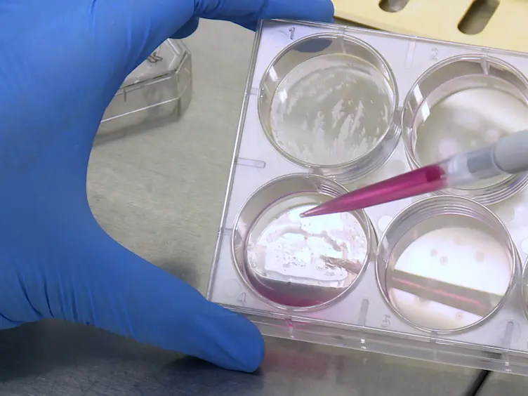 Generation of Standardized and Reproducible Forebrain-type Cerebral Organoids from Human Induced Pluripotent Stem Cells
