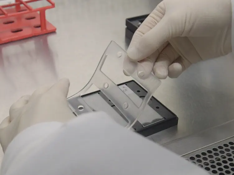 Zika Virus Specific Diagnostic Epitope Discovery