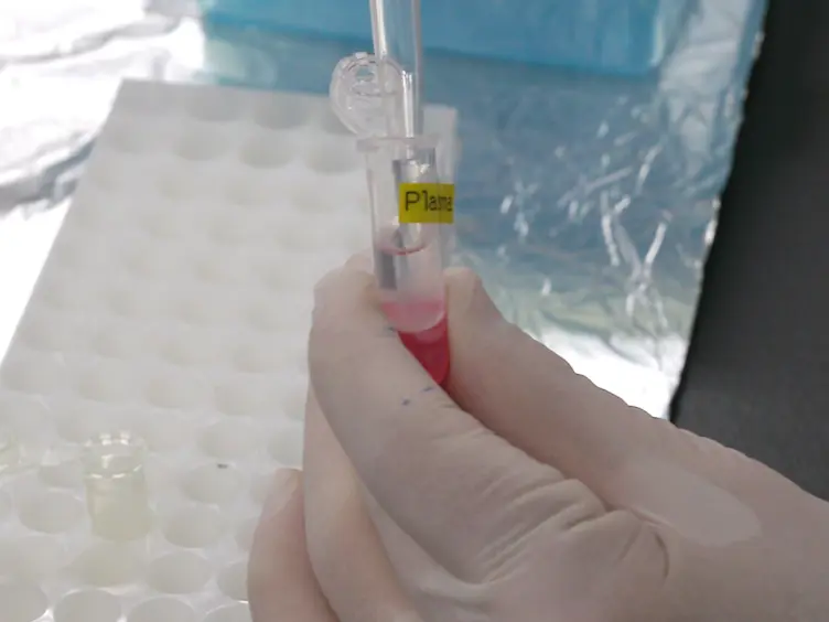 Absolute Quantification of Plasma MicroRNA Levels in Cynomolgus Monkeys, Using Quantitative Real-time Reverse Transcription PCR
