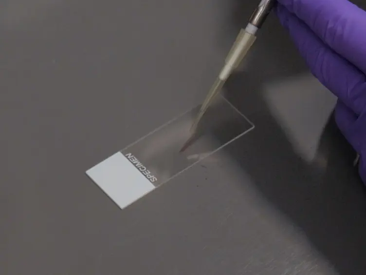 Automated Measurement of <em>Cryptococcal</em> Species Polysaccharide Capsule and Cell Body