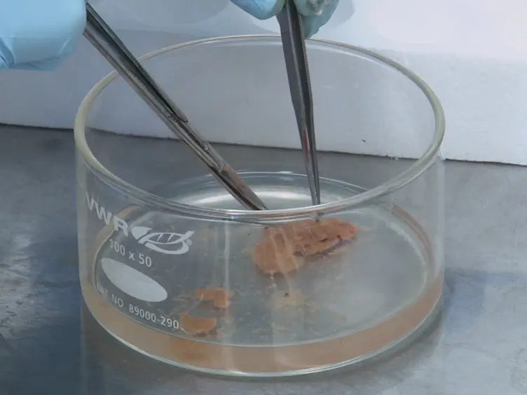 Purification of Hepatocytes and Sinusoidal Endothelial Cells from Mouse Liver Perfusion