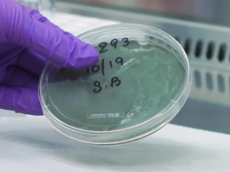 Histological Quantification to Determine Lung Fungal Burden in Experimental Aspergillosis