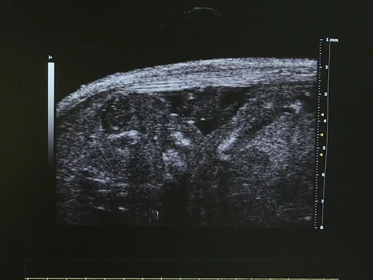 Fetal Mouse Cardiovascular Imaging Using a High-frequency Ultrasound (30/45MHZ) System