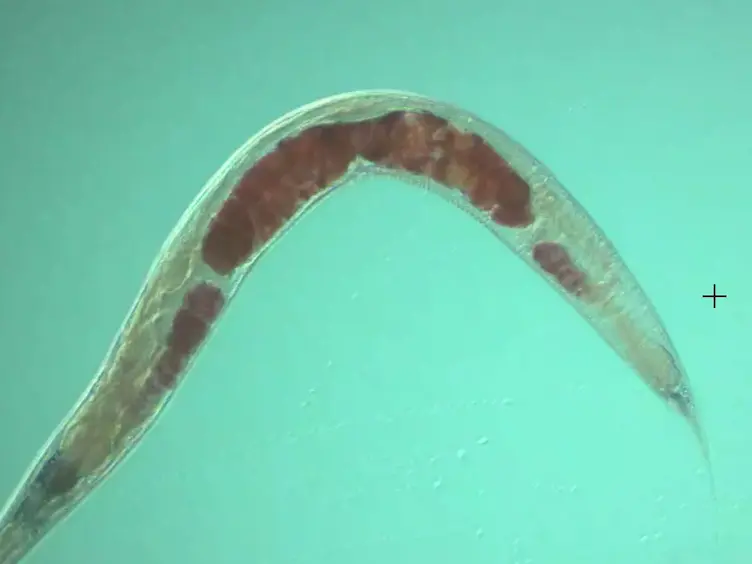 Quantification of Lipid Abundance and Evaluation of Lipid Distribution in <em>Caenorhabditis elegans</em> by Nile Red and Oil Red O Staining