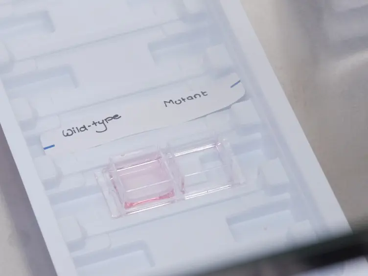 Live Cell Imaging of Chromosome Segregation During Mitosis