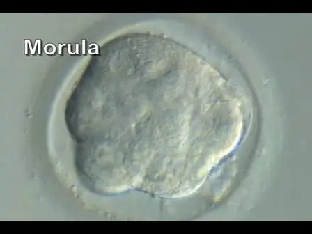 Derivation of Human Embryonic Stem Cells by Immunosurgery