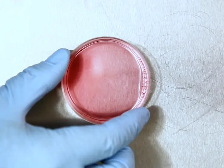 Intraportal Transplantation of Pancreatic Islets in Mouse Model