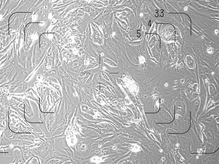 Suppression of Pro-fibrotic Signaling Potentiates Factor-mediated Reprogramming of Mouse Embryonic Fibroblasts into Induced Cardiomyocytes
