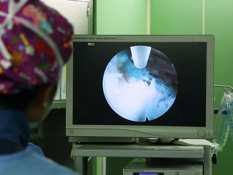 A Mobile Outside-in Technique of Transforaminal Lumbar Endoscopy for Lumbar Disc Herniations