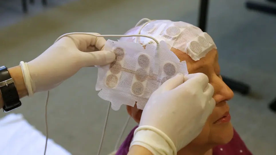 The Clinical Application of Tumor Treating Fields Therapy in Glioblastoma