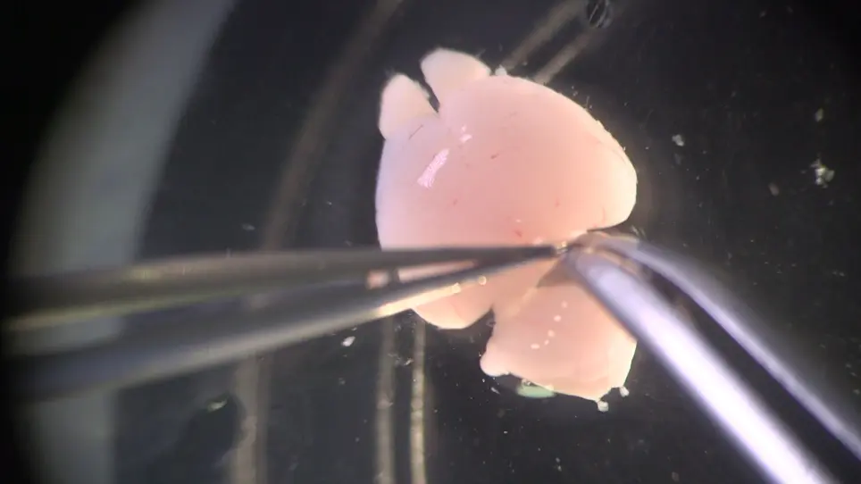 Preparation and Immunostaining of Myelinating Organotypic Cerebellar Slice Cultures