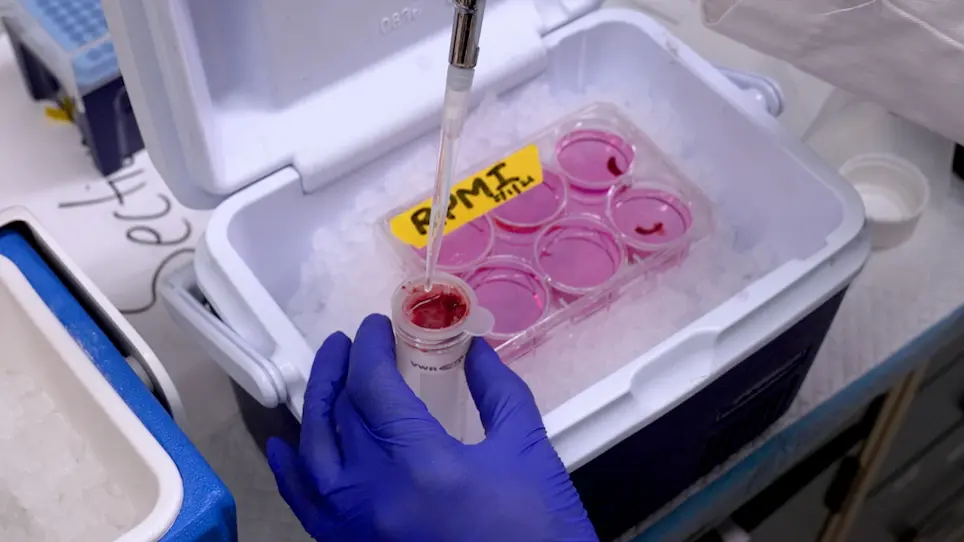 Induction of Drug-Induced, Autoimmune Hepatitis in BALB/c Mice for the Study of Its Pathogenic Mechanisms