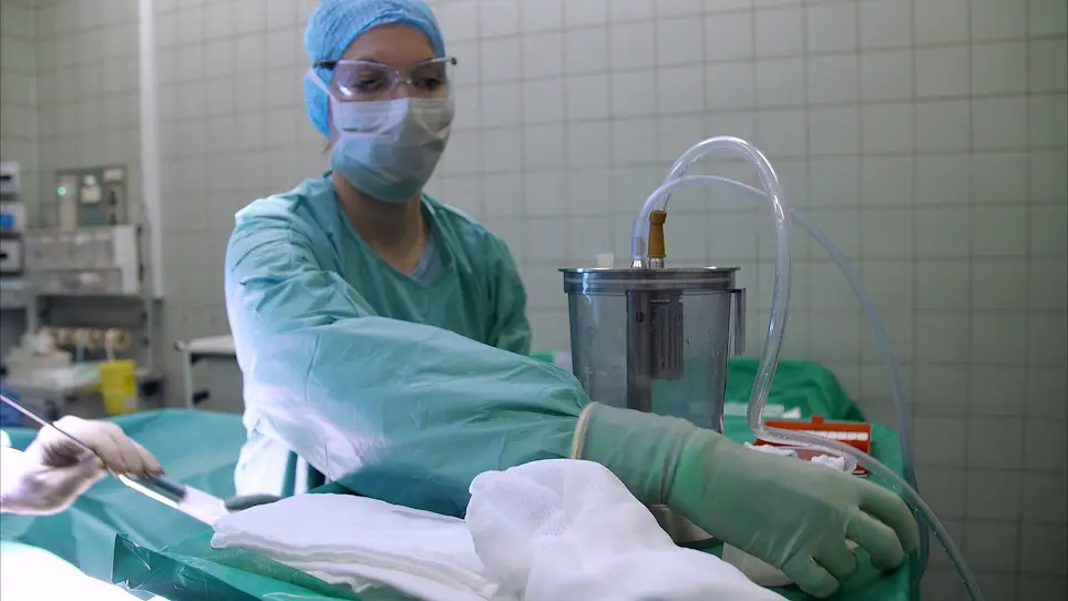 Isolation of Adipose Derived Regenerative Cells for the Treatment of Erectile Dysfunction Following Radical Prostatectomy