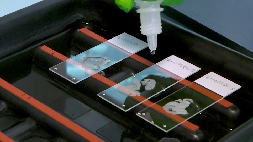 Chromogenic In Situ Hybridization as a Tool for HPV-Related Head and Neck Cancer Diagnosis