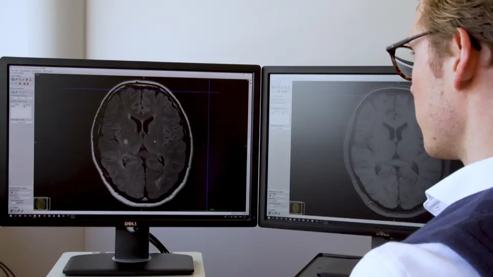 Brain Infarct Segmentation and Registration on MRI or CT for Lesion-symptom Mapping
