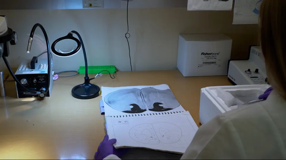 Collection of Frozen Rodent Brain Regions for Downstream Analyses