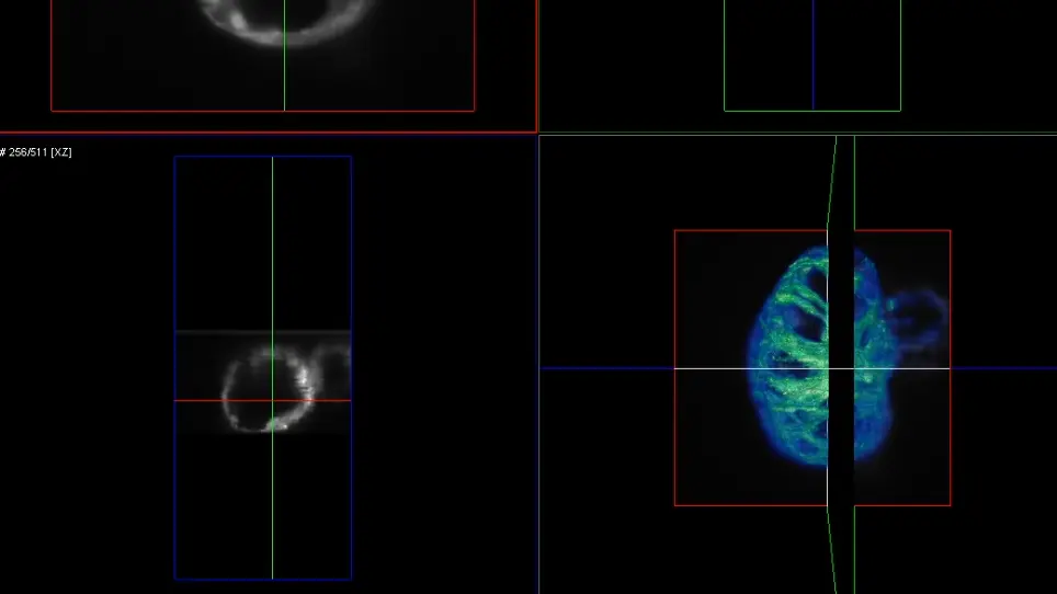 Displacement Analysis of Myocardial Mechanical Deformation (DIAMOND) Reveals Segmental Heterogeneity of Cardiac Function in Embryonic Zebrafish