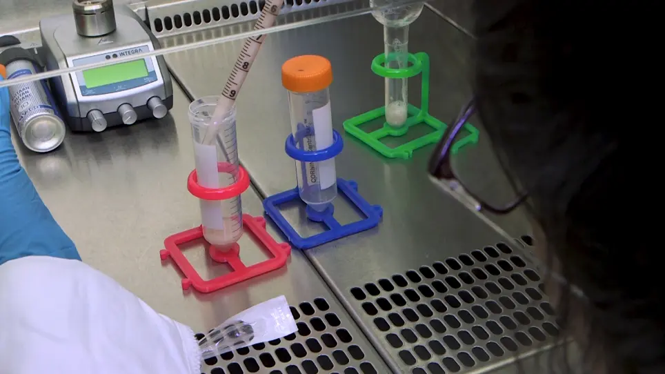A High Output Method to Isolate Cerebral Pericytes from Mouse