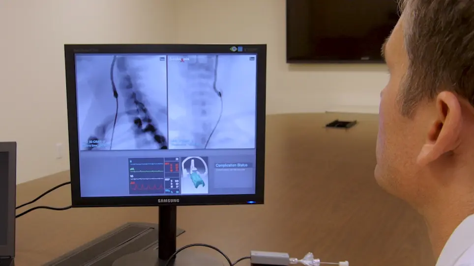 Simulator Training for Endovascular Neurosurgery