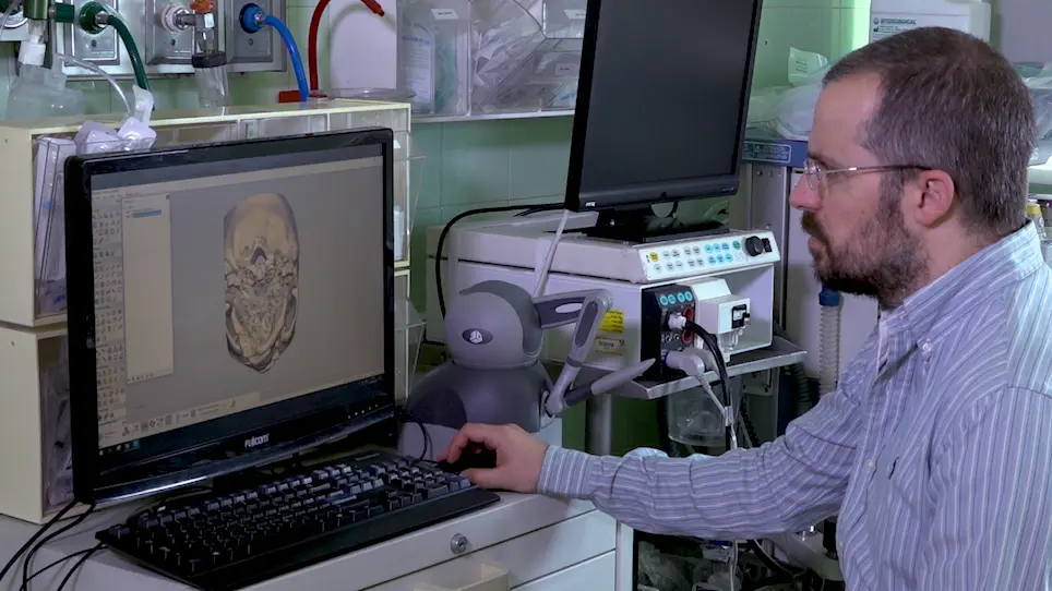 3D Planning and Printing of Patient Specific Implants for Reconstruction of Bony Defects