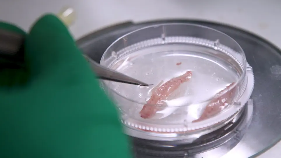 Purification of Fibroblasts and Schwann Cells from Sensory and Motor Nerves in Vitro