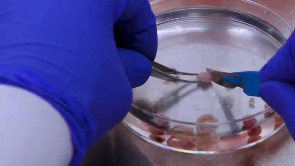 Measuring Real-time Drug Response in Organotypic Tumor Tissue Slices