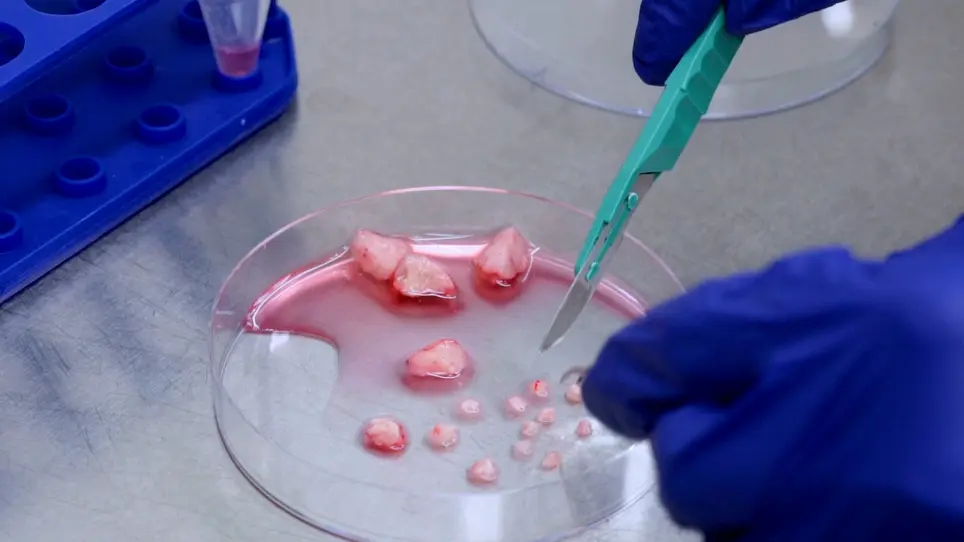 Orthotopic Transplantation of Breast Tumors as Preclinical Models for Breast Cancer