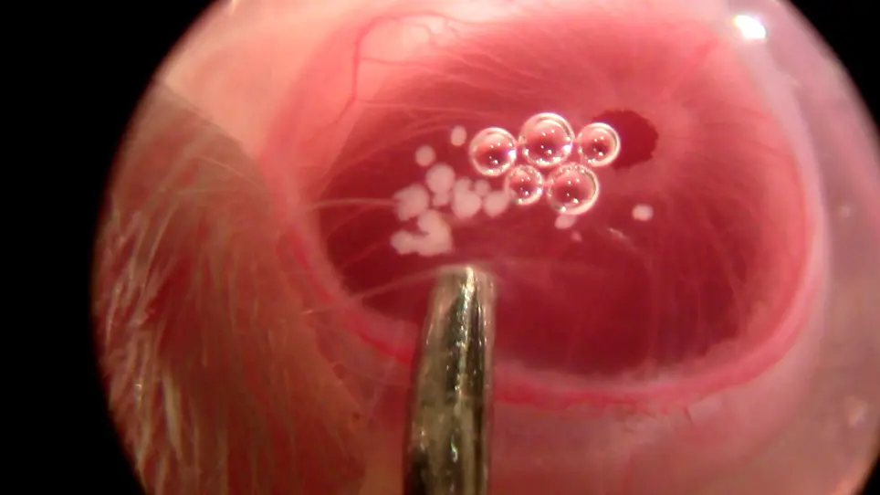 Longitudinal In Vivo Imaging and Quantification of Human Pancreatic Islet Grafting and Contributing Host Cells in the Anterior Eye Chamber