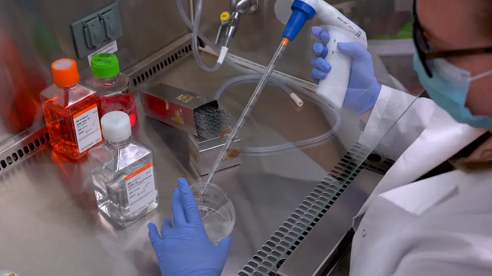 Pathological Analysis of Lung Metastasis Following Lateral Tail-Vein Injection of Tumor Cells