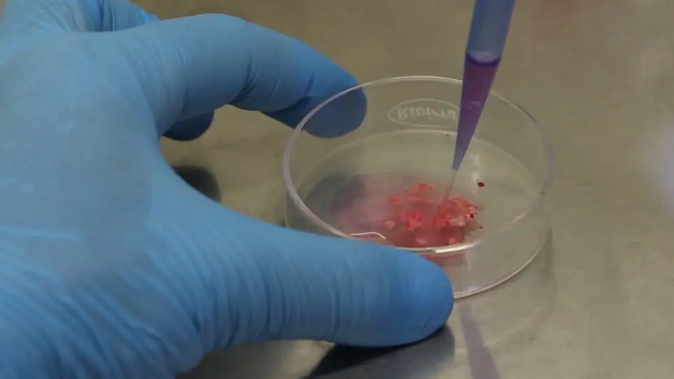 Obtaining Human Microglia from Adult Human Brain Tissue