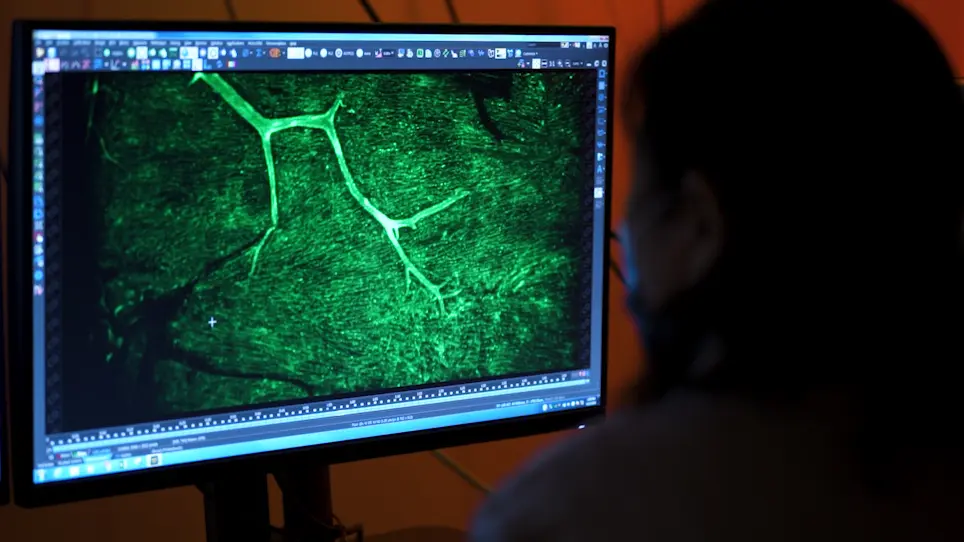 Dynamic Measurement and Imaging of Capillaries, Arterioles, and Pericytes in Mouse Heart