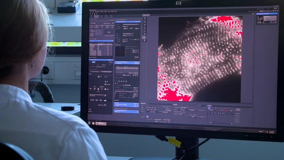Analyzing the &alpha;-Actinin Network in Human iPSC-Derived Cardiomyocytes Using Single Molecule Localization Microscopy