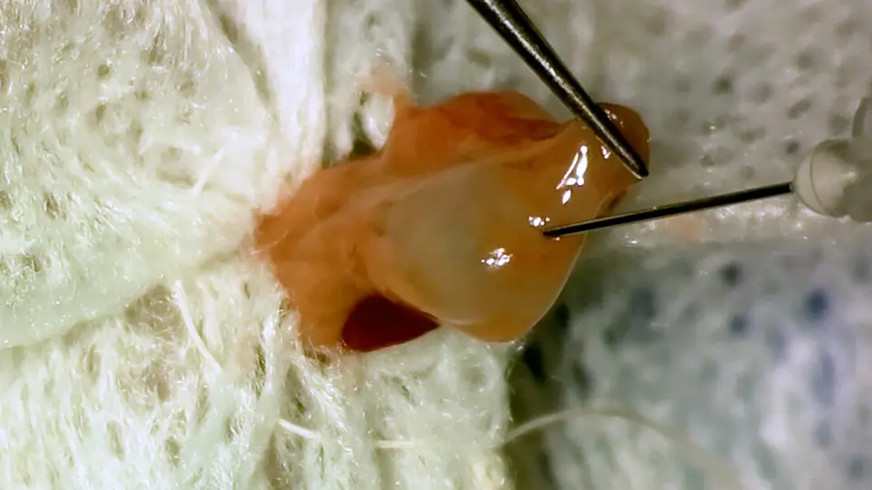 An Orthotopic Resectional Mouse Model of Pancreatic Cancer