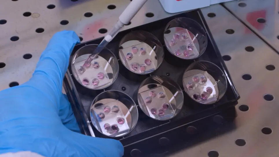 Microfluidic Co-Culture Models for Dissecting the Immune Response in in vitro Tumor Microenvironments