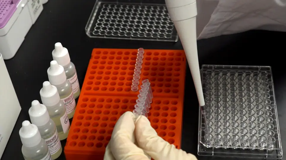 Assessing Whole-Body Lipid-Handling Capacity in Mice