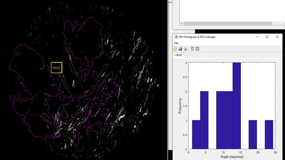 Quantifying Fibrillar Collagen Organization with Curvelet Transform-Based Tools