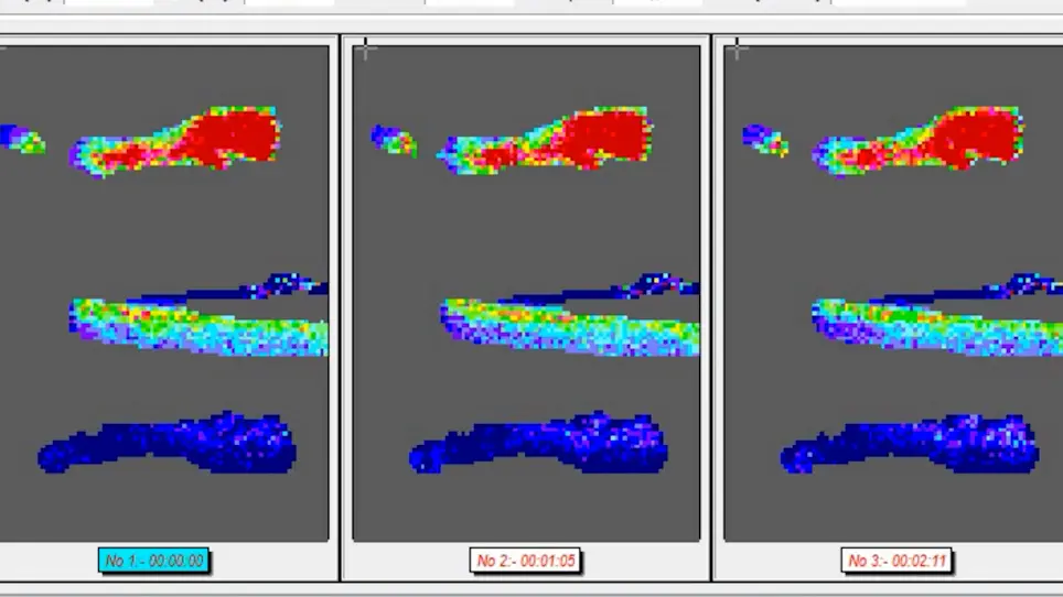 Laser Doppler Perfusion Imaging in the Mouse Hindlimb