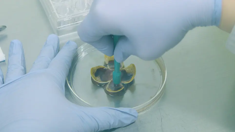 Characterization of a Novel Human Organotypic Retinal Culture Technique