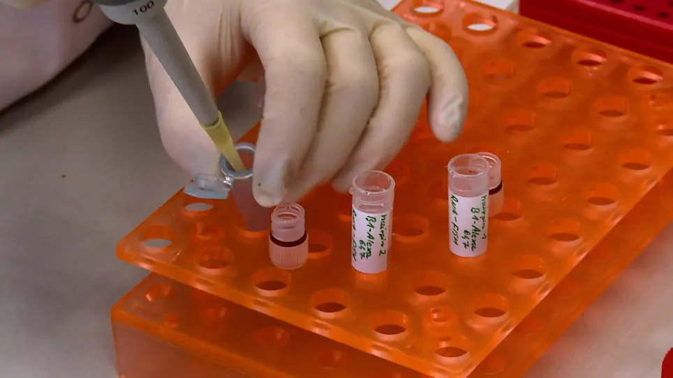Visualization of SARS-CoV-2 using Immuno RNA-Fluorescence In Situ Hybridization