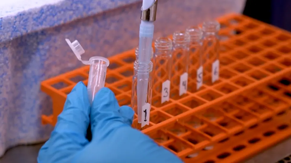 Preparation of Human Tissues Embedded in Optimal Cutting Temperature Compound for Mass Spectrometry Analysis
