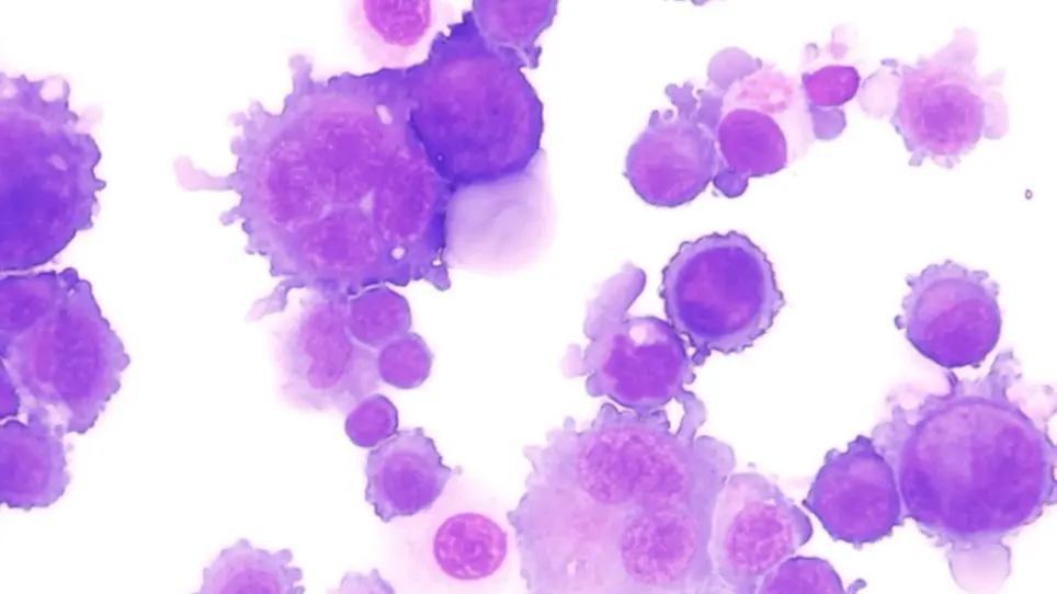 Immunophenotyping and Cell Sorting of Human MKs from Human Primary Sources or Differentiated <em>In Vitro</em> from Hematopoietic Progenitors
