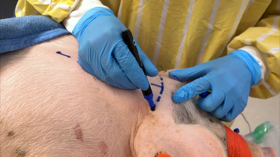 Direct Cannula Implantation in the Cisterna Magna of Pigs