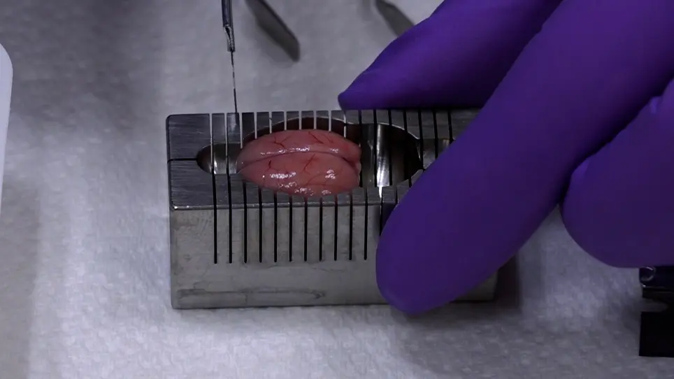 Rodent Heart and Brain Tissue Preparation for Digital Macro Photography after Ischemia-reperfusion