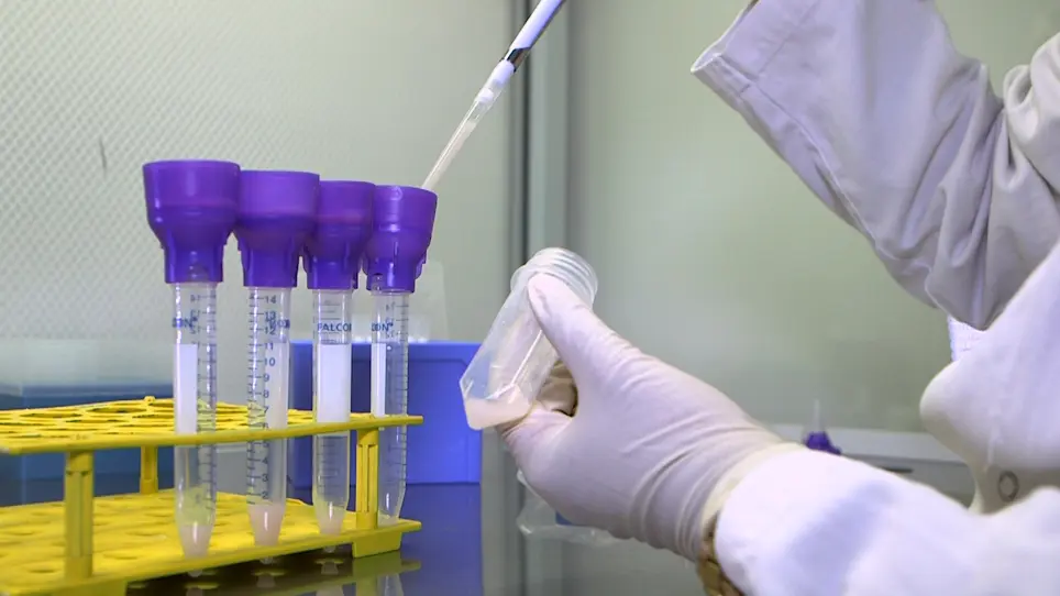 Magnetic Isolation of Microglial Cells from Neonate Mouse for Primary Cell Cultures