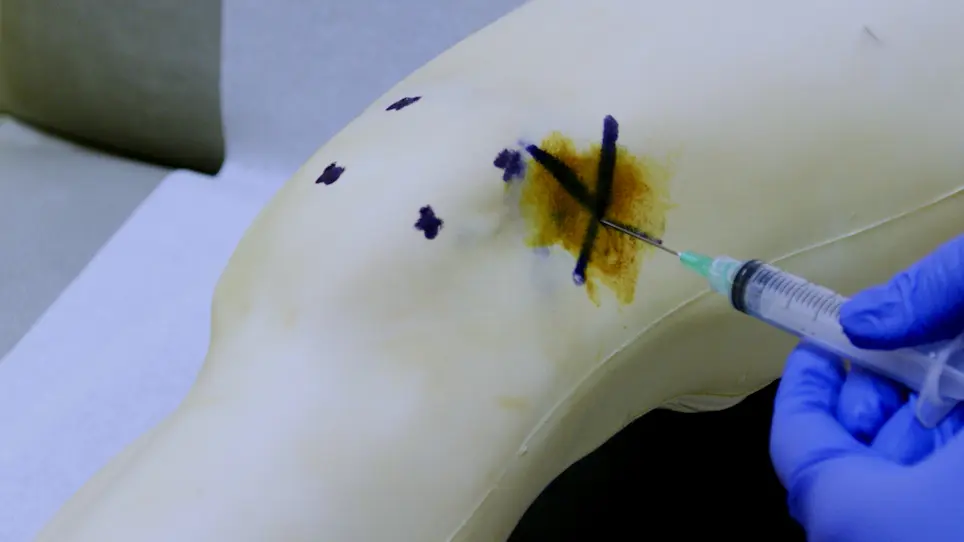 Knee Arthrocentesis in Adults
