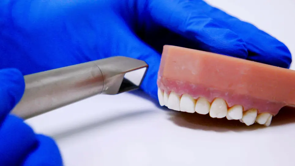 Detection and Removal of Tooth-Colored Composite Resin Using the Fluorescence-Aided Identification Technique